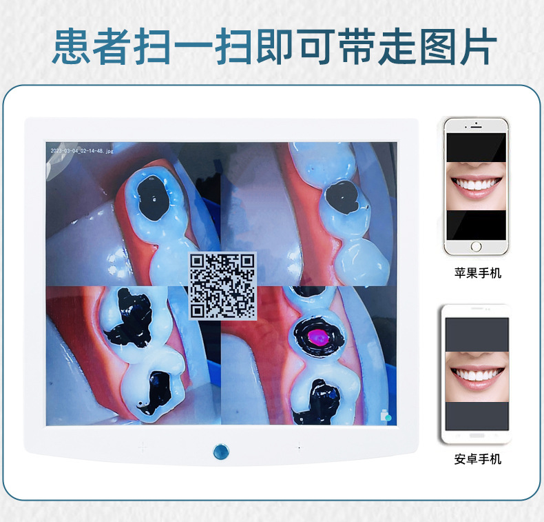 口腔观察仪_11