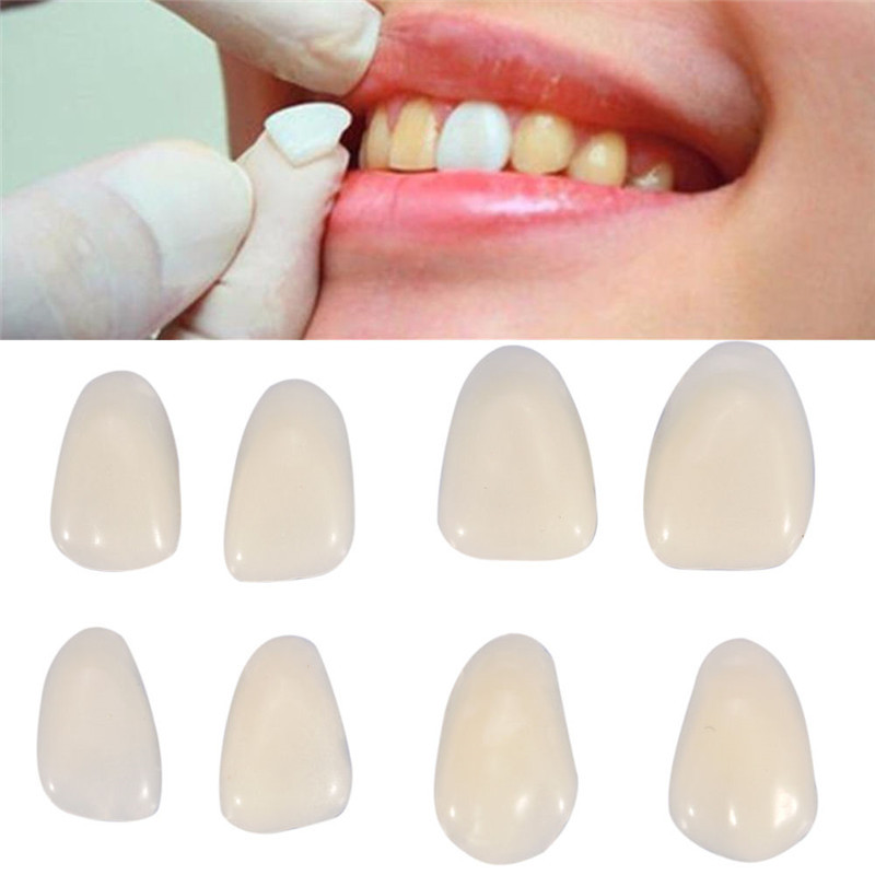 牙科牙贴面 贴片 A1 A2色牙片 临时牙齿贴面 口腔齿科器材 牙贴片