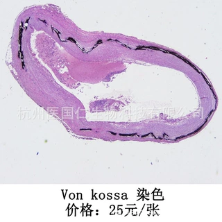 Von kossa染色 组织样本病理技术服务
