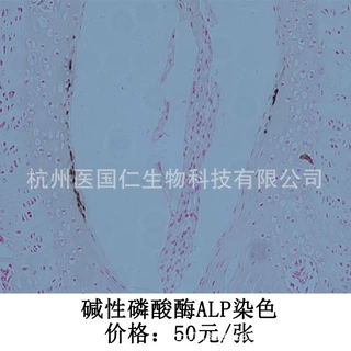 碱性磷酸酶染色（ALP） 组织样本病理技术服务