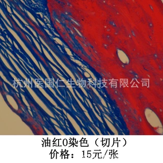 油红O染色 组织样本病理技术服务