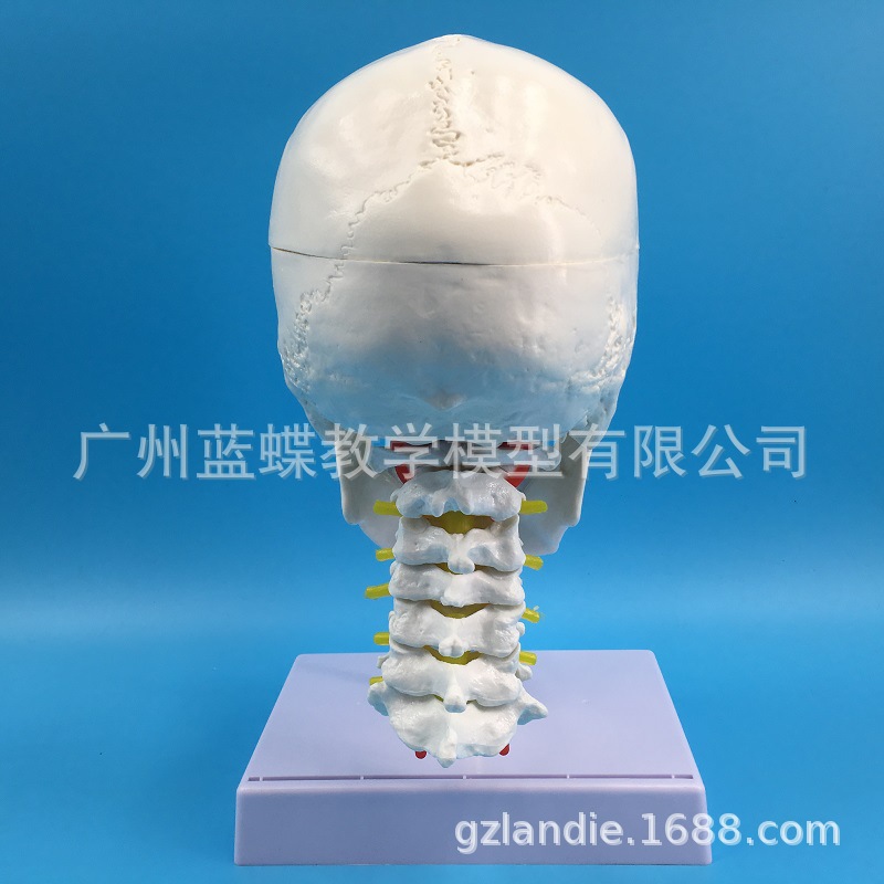 ����ͷ�Ǵ���׵ģ�� ��Ȼ����������ͷ ����ͷ�Ǿ�׵����ͷ­�걾