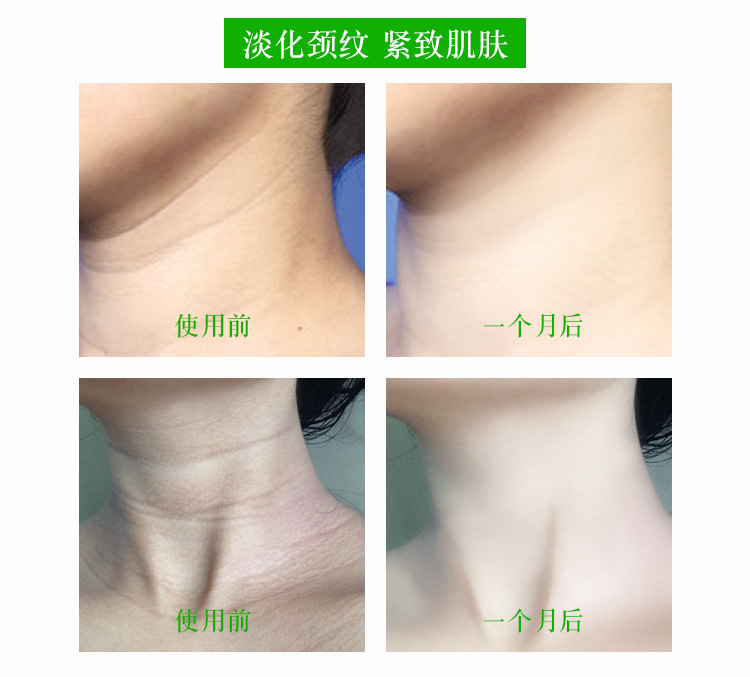 Six peptide beauty neck cream, neck protection, firming skin, removal of neck lines, brightening neck, smooth skin, body and neck care
