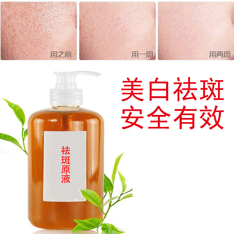美白祛斑液去黄褐斑雀斑美白去黄分解色素防回流美容院祛斑精华液
