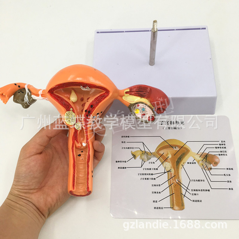 �����ӹ�ģ�ͽ̾�ģ�������ѳ����ʲ���ҽѧŮ�Է���Ů����ֳģ��