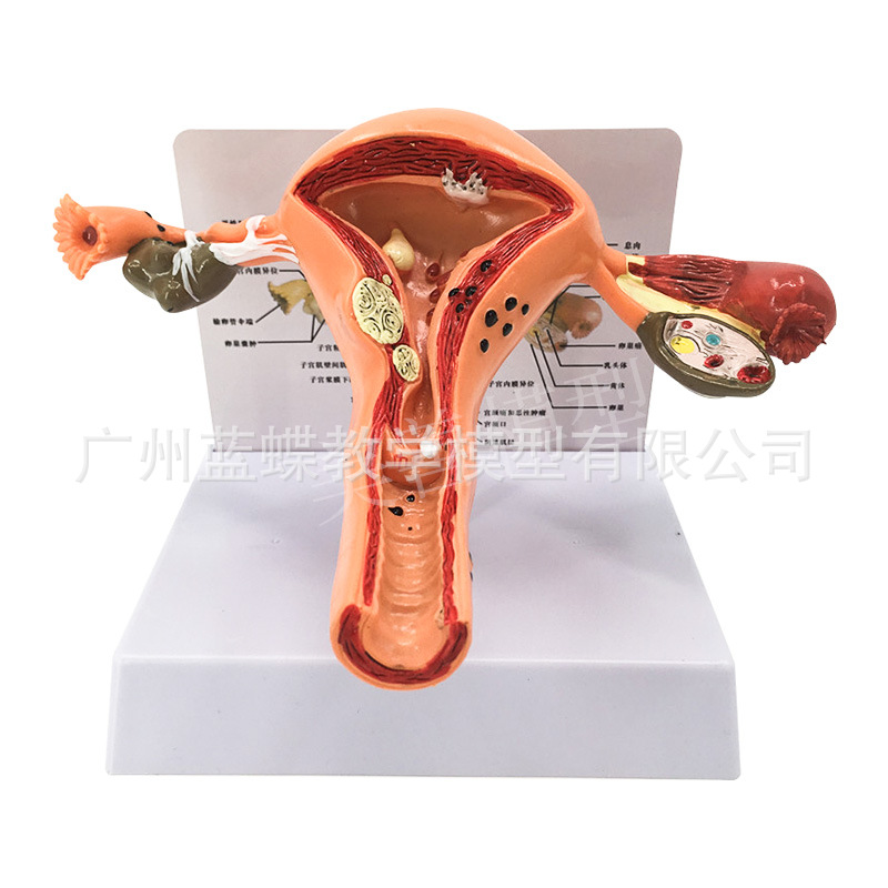 �����ӹ�ģ�ͽ̾�ģ�������ѳ����ʲ���ҽѧŮ�Է���Ů����ֳģ��