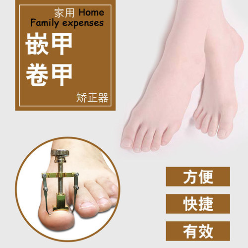 Nail groove ingrown toenail corrector curled manicure toe correction corrector toe nail clipper manicure set inflammation