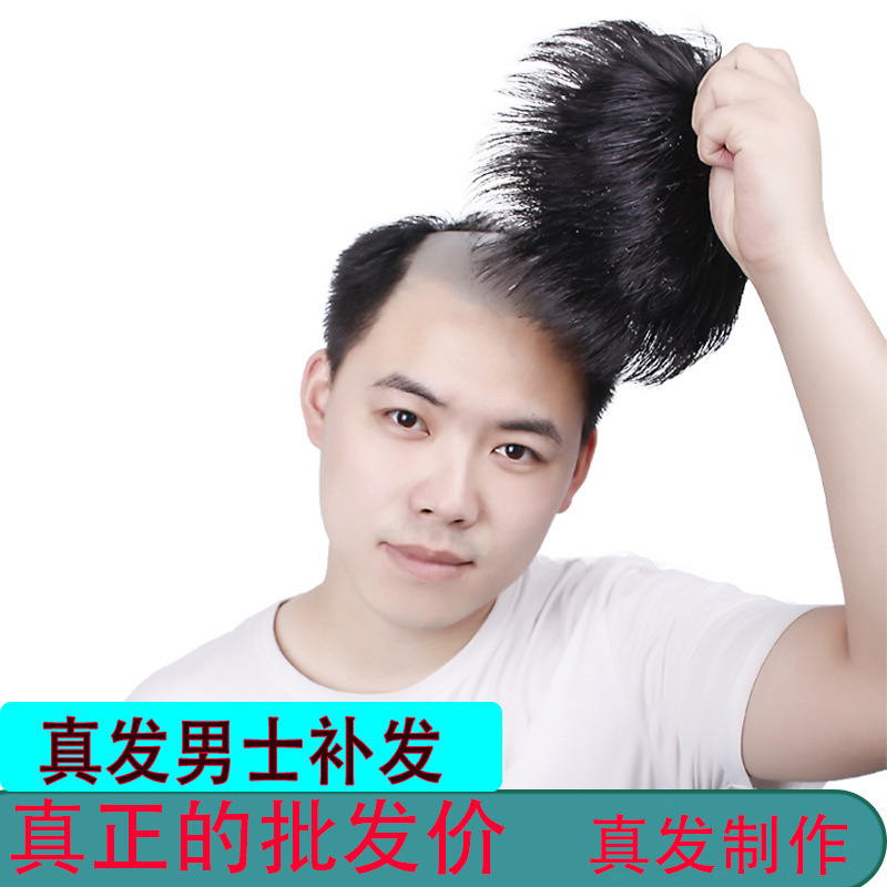 Men's hair replacement piece wig cover head hair replacement forehead bald hair replacement pad hair extension flip wig real hair men's hair block
