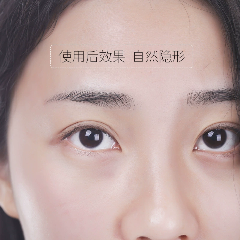 [爆款批发malian玛莉安卷筒眼皮贴 蕾丝网状双眼皮贴隐形300回]