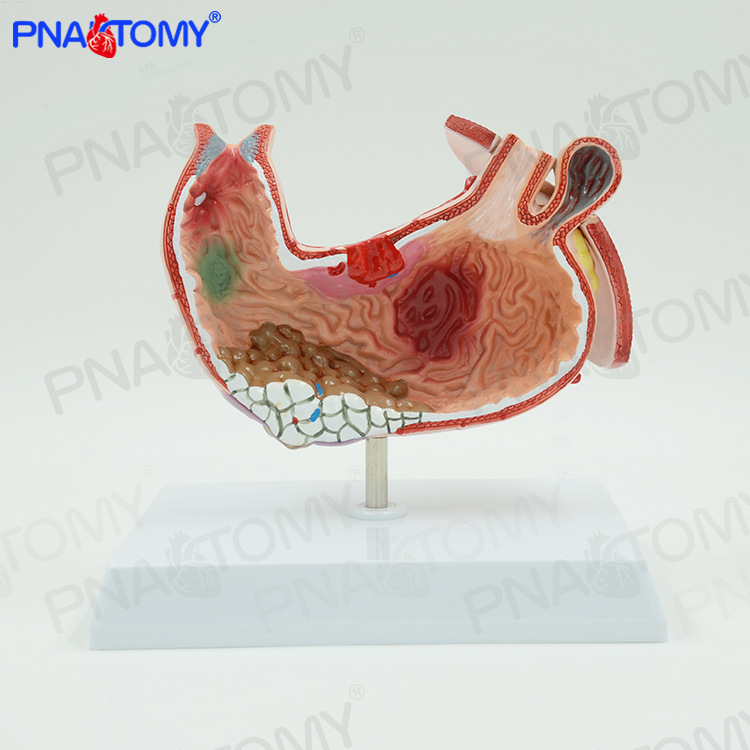 人体胃结构消化系统解剖模型病理展示标本医学内脏器官消化内科