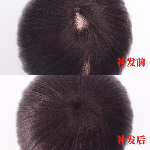 Wig piece top hair replacement piece covering white hair one piece real hair female top hair cover fluffy natural traceless hair replacement piece female