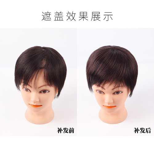 Wig piece top hair replacement piece covering white hair one piece real hair female top hair cover fluffy natural traceless hair replacement piece female