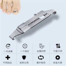 梵庄公正甲扣正甲贴物理拉伸拉拉正甲贴反拉作用嵌甲克星指甲斜口