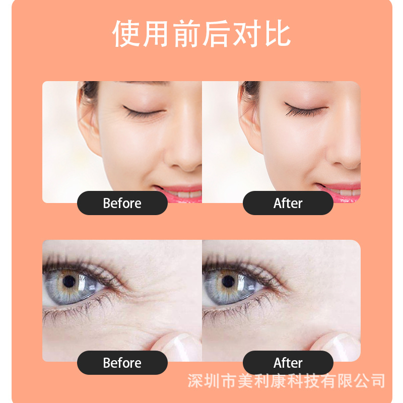Dispositivo de Belleza para Ojos Tilamei, Microcorriente EMS, Mejora las Ojeras y las Bolsas de los Ojos, Dispositivo de Belleza Ultrasónico, Masajeador de Ojos para el Hogar image 6