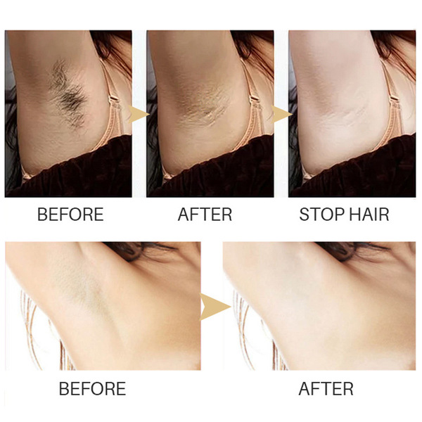 Hair inchibition hair moisturizing liquid droplet bottle bottle