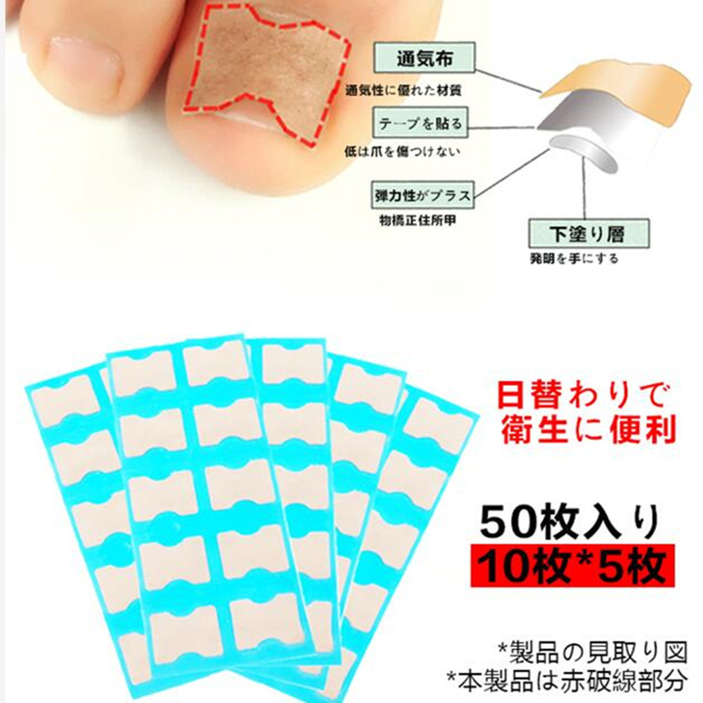 Paroniquia-libre de pegamento pasta de uñas pasta de pasta libre de alisado dispositivo