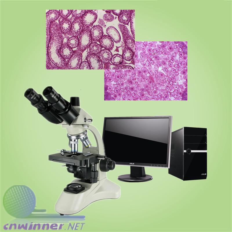 供应三目生物显微镜 WH50生物显微镜 血液分析显微镜