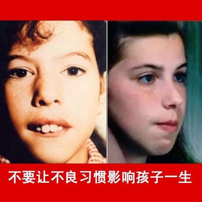 防止张口呼吸矫正贴睡觉张嘴巴打呼噜神器闭嘴封口止鼾唇贴嘴