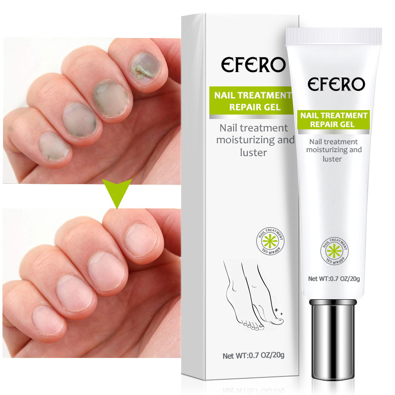 Cross-Border Hot Selling Efero Nail Gel Nail Liquid Plant Nail Liquid Longwei Nail Protection