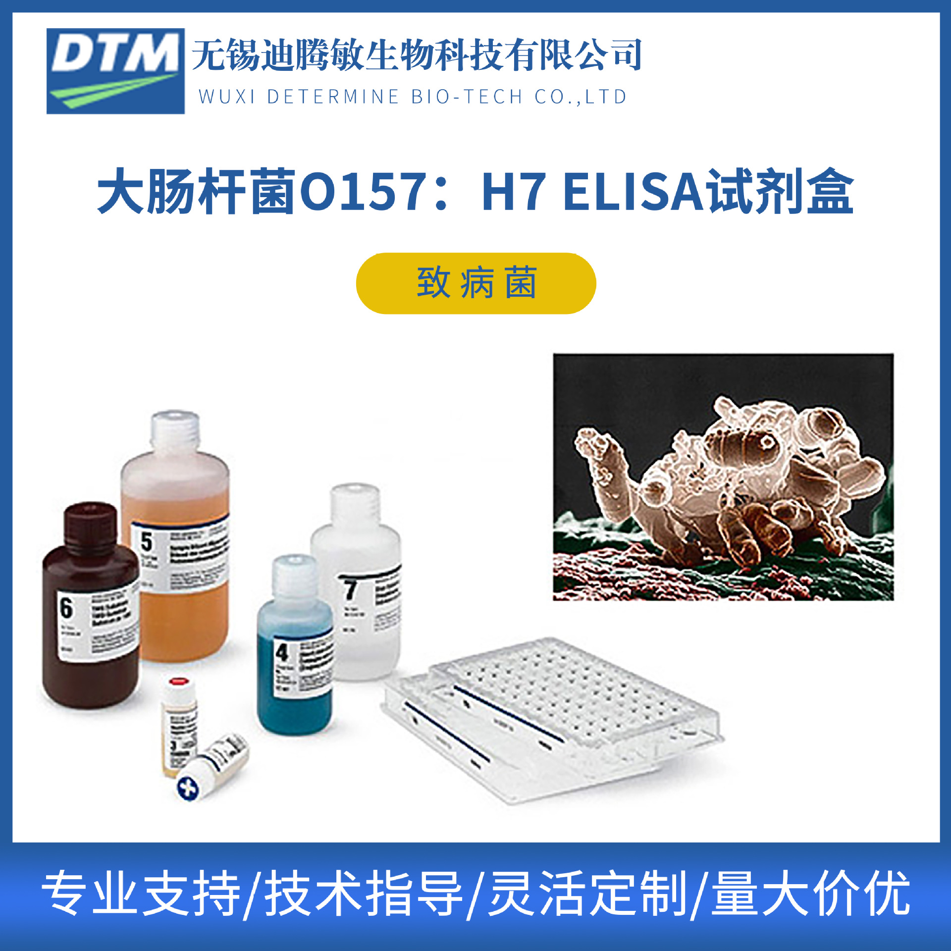 厂家供应 大肠杆菌O157:H7试剂盒 ELISA检测试剂盒双抗夹心法