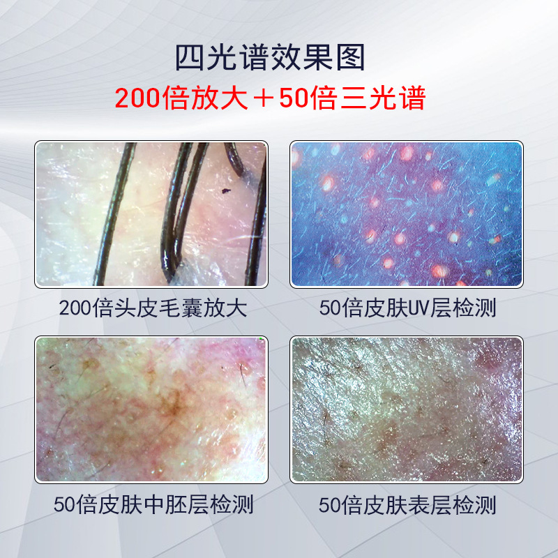 Tector folículo piloso l cuero cabelludo tres espectros piel hd cuatro rejillas contraste almacenamiento fotos doble lente peluquería