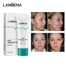 LANBENA������ACNE TREATMENT GEL��������20g LB5453