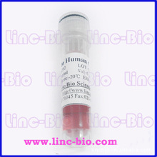 甲状腺球蛋白 Human Thyrogloblin (TG)