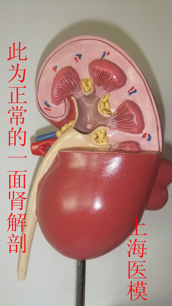人体解剖模型 肾解剖模型 自然大肾解剖附肾上腺模型 肾上腺模型-阿里巴巴