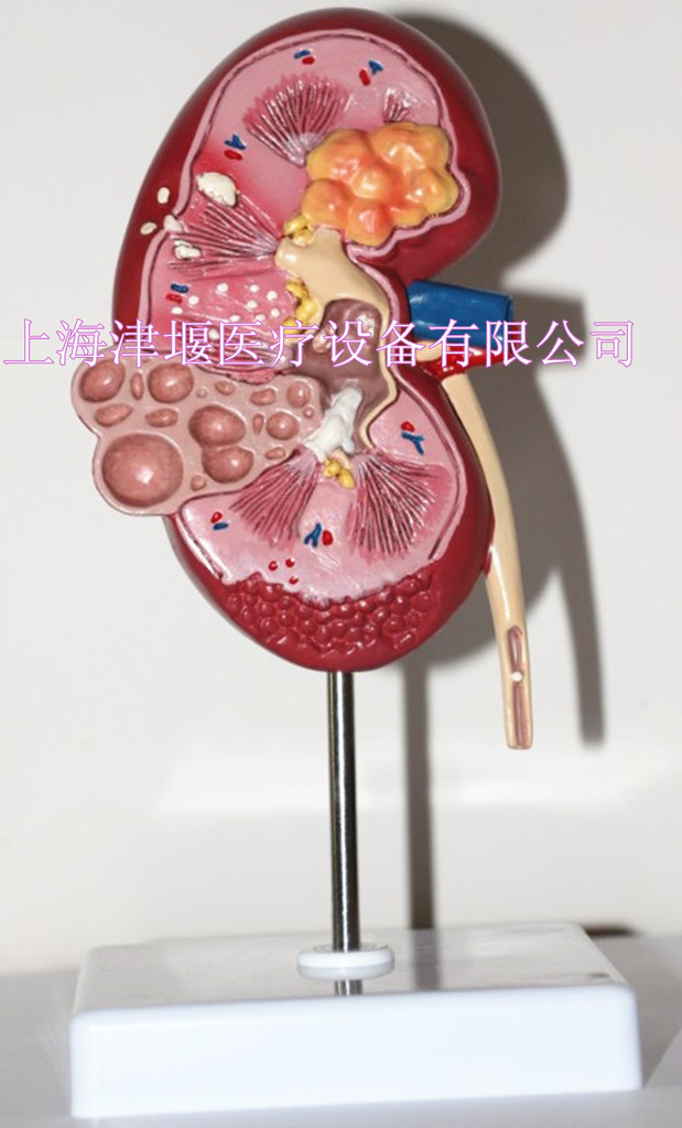 人体解剖模型 肾解剖模型 自然大肾解剖附肾上腺模型 肾上腺模型-阿里巴巴