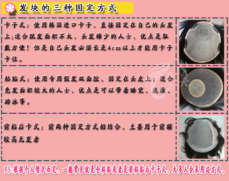 发块的三种固定方式国内用