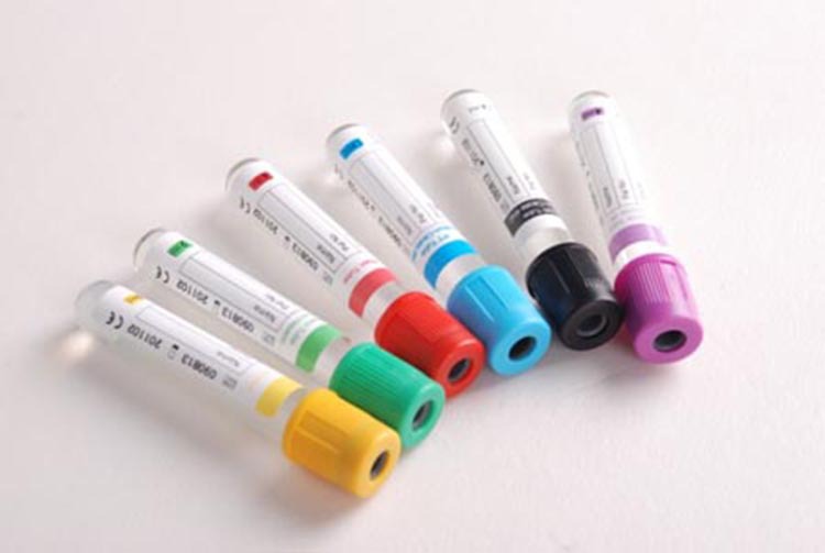 Kết quả hình ảnh cho tubo de ensaio para coleta de sangue