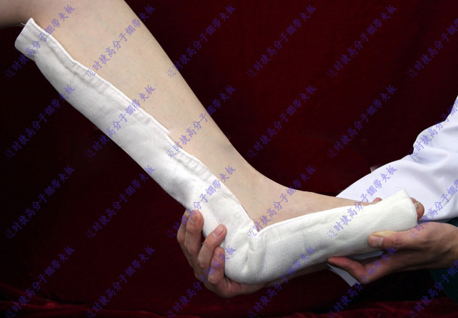 高分子石膏,高分子繃帶,高分子夾板@邁時捷