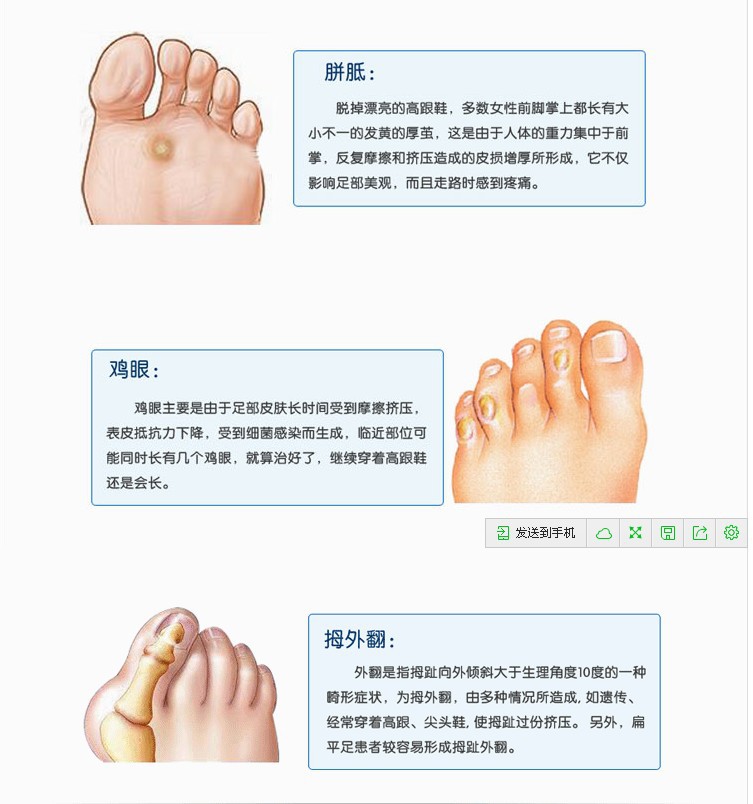 拇外翻矫正袜子 硅胶防磨 布拇囊炎护理 前掌垫 大脚趾保护 包邮-阿里巴巴