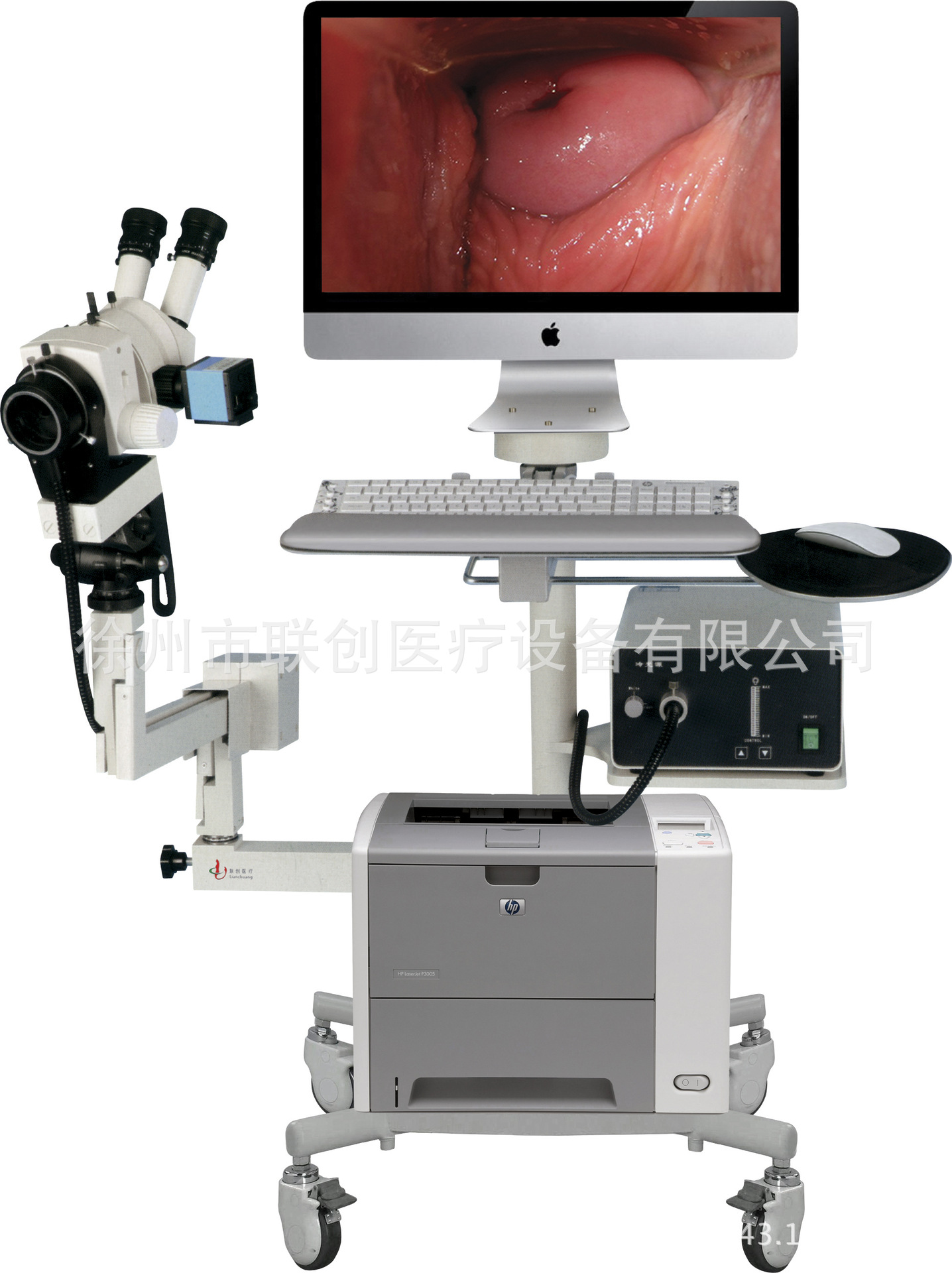 蘋果一體機光學陰道鏡LC-9200C