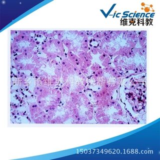 肾小管上皮细胞水肿 生物切片  医学组织学类 细胞和组织损伤