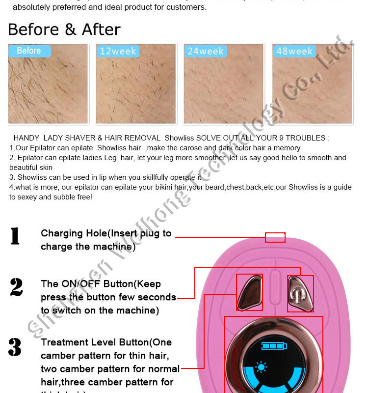 home use hair removal (9)