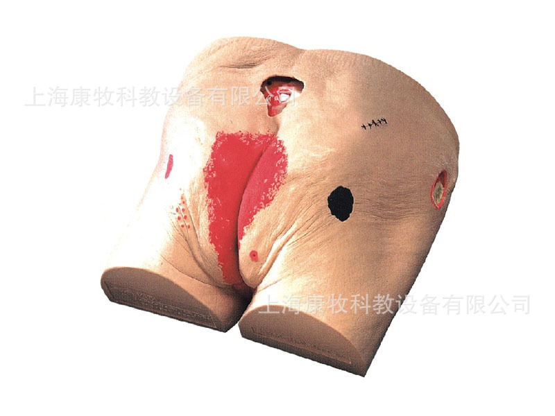高级褥疮护理模型