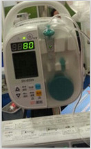 肠内营养泵/胃肠营养泵/喂养泵/喂食泵