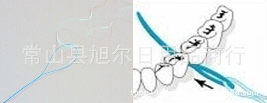 牙线引线