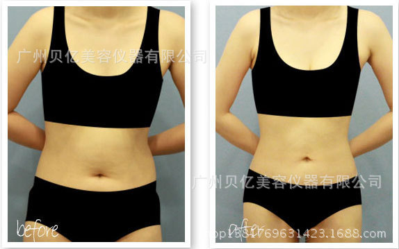 批發 貼片經絡減肥機 電療養生機 導入導出正負電離子塑形美容機