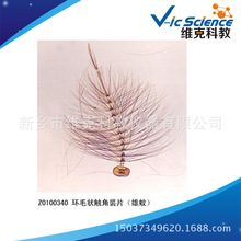 �hë���|���bƬ������)  ��֫�����T ��ֲ����Ƭ�˱� �@΢�R��