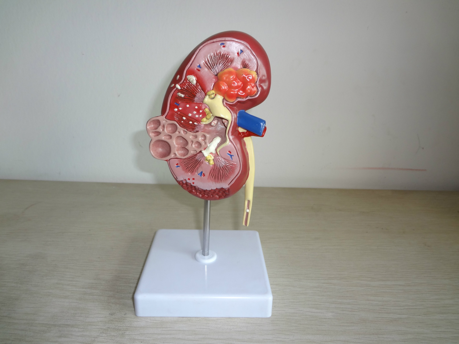 世界肾脏日 | 如何保护好你的肾，看这张图就够了_Kidney_症状_疾病