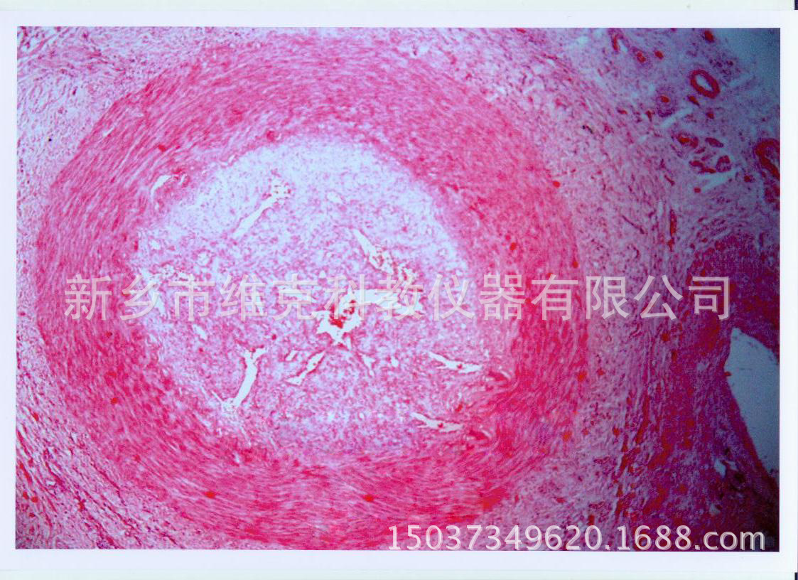 混合血栓切片 医学组织学类 局部血液循环障碍 生物教学器材-阿里巴巴