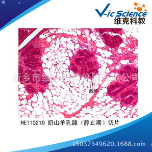 ��ɽ�����٣��oֹ�ڣ� �M���W ��ֳϵ�y ��ֲ����Ƭ�˱� �@΢�R��