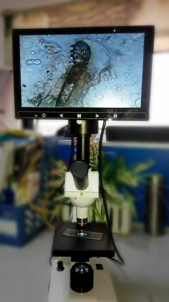 [Пожизненная гарантия] Кожа Лицо скальп Обнаружение клещей головка клещей Инструмент Микроскоп