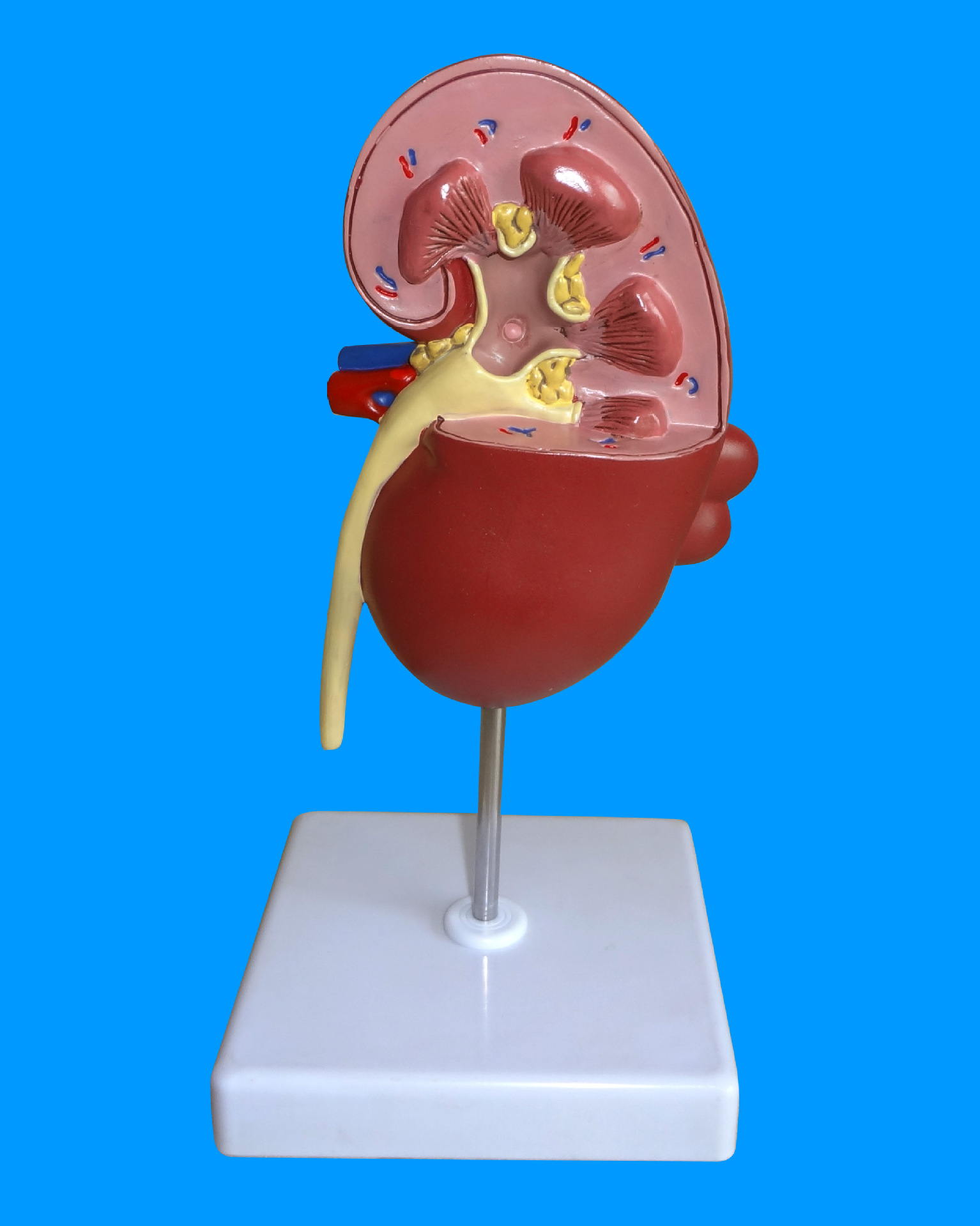 人体肾解剖模型,病变肾脏模型 肾脏模型 人体内脏器官解剖模型-阿里巴巴