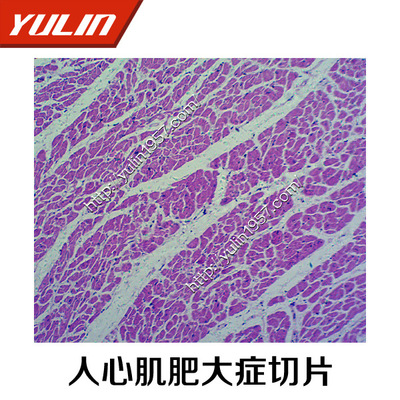人体病理学细胞组织损伤及修复生物玻片标本 生物切片 批发人心肌-阿里巴巴