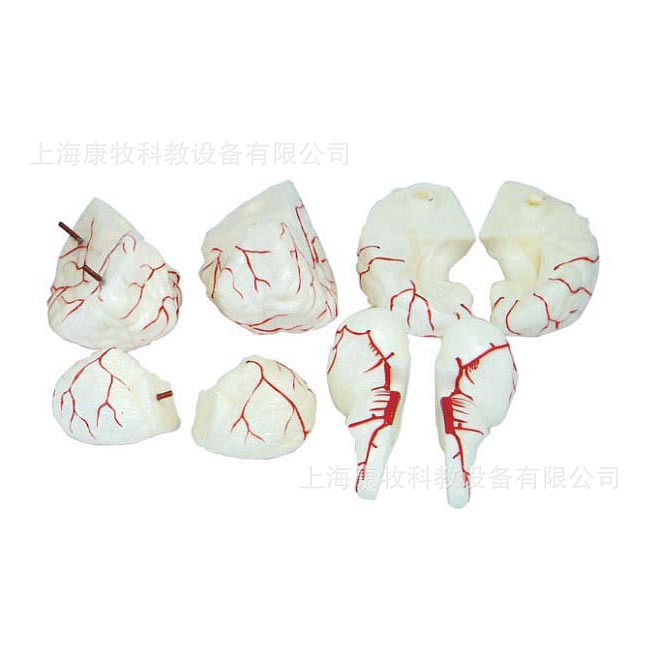 脑动脉模型