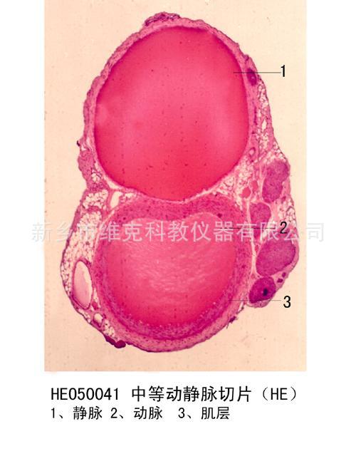 中等動靜脈切片