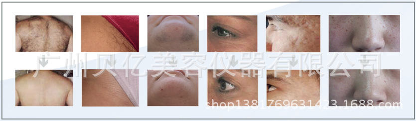 OPT冰點脫毛機 無痛祛斑嫩膚機 IPL光子祛痘 E光升級版OPT美容機